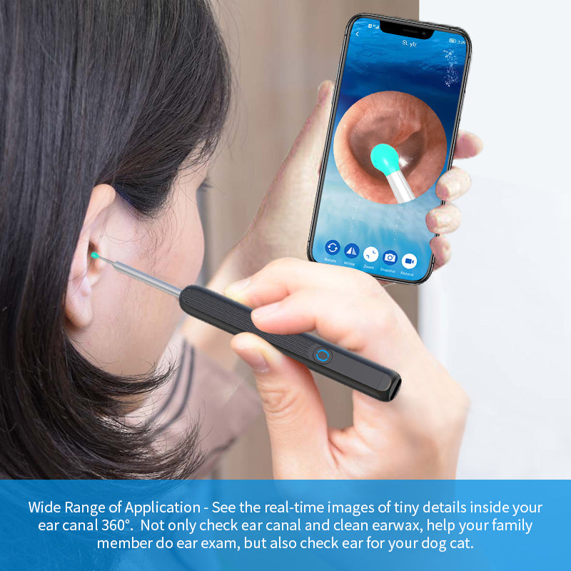 LED Light Wireless Ear Endoscope - Epic@Care